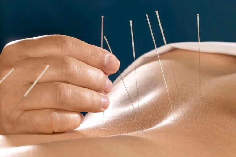 лечения алкоголизма с использованием иглоукалывания